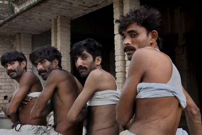 india-organ-trafficking